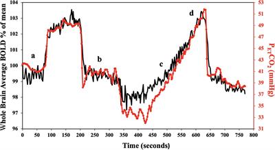 The Reproducibility of Cerebrovascular Reactivity Across MRI Scanners